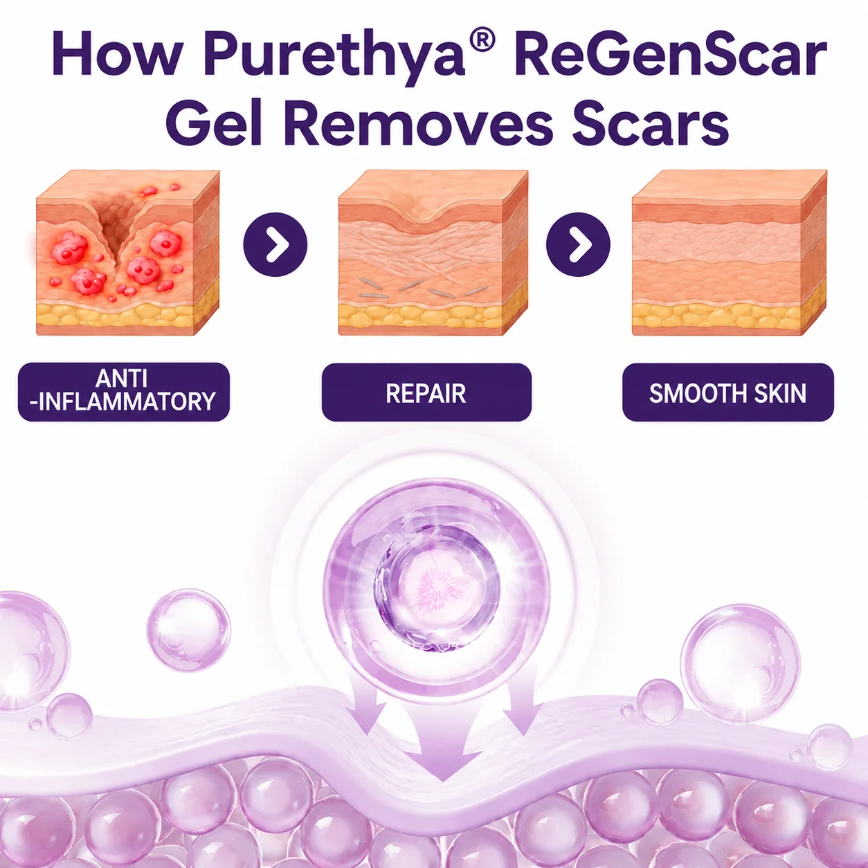 Purethya® ReGenScar Stem Cell Scar Gel - Image 3