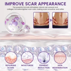 Alternative view of Purethya® ReGenScar Stem Cell Scar Gel